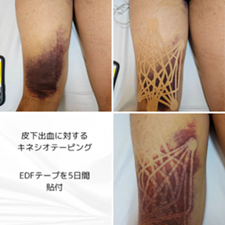コラム：サムネイル画像